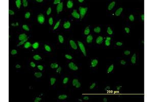 Immunofluorescence of monoclonal antibody to NFX1 on HeLa cell. (NFX1 抗体  (AA 981-1080))