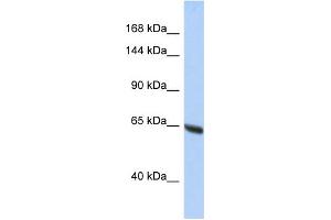 Western Blotting (WB) image for anti-Chromosome 14 Open Reading Frame 49 (C14orf49) (N-Term) antibody (ABIN2785211) (Nesprin3 抗体  (N-Term))