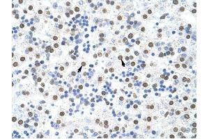 MSI2 antibody was used for immunohistochemistry at a concentration of 4-8 ug/ml to stain Hepatocytes (arrows) in Human Liver. (MSI2 抗体)