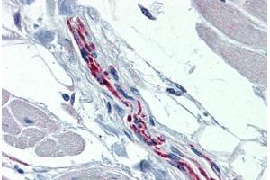 Human Heart, Nerve (formalin-fixed, paraffin-embedded) stained with TH antibody ABIN364267 at 1:100 followed by biotinylated goat anti-rabbit IgG secondary antibody ABIN481713, alkaline phosphatase-streptavidin and chromogen. (Tyrosine Hydroxylase 抗体)