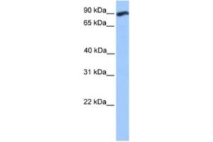 Western Blotting (WB) image for anti-WD Repeat and FYVE Domain Containing 3 (WDFY3) antibody (ABIN2463379) (WDFY3 抗体)