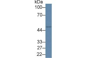Detection of RIPK2 in Rat Placenta lysate using Polyclonal Antibody to Receptor Interacting Serine Threonine Kinase 2 (RIPK2) (RIPK2 抗体  (AA 1-294))