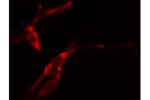 ABIN6274364 staining COLO205 cells by IF/ICC. (ANKRD1 抗体  (Internal Region))