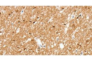 Immunohistochemistry of paraffin-embedded Human brain using AMZ1 Polyclonal Antibody at dilution of 1:80 (AMZ1 抗体)