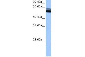 WB Suggested Anti-RARB Antibody Titration:  0. (Retinoic Acid Receptor beta 抗体  (C-Term))