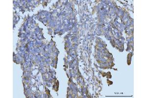 IHC analysis of BCKDK using anti-BCKDK antibody (ABIN7601470).