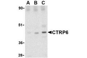 Western blot analysis of CTRP6 in mouse brain cell lysate with AP30257PU-N CTRP6 antibody at (A) 0. (CTRP6 抗体  (Intermediate Domain))