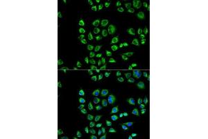 Immunofluorescence analysis of HeLa cells using CD1D antibody (ABIN3022497, ABIN3022498, ABIN3022499 and ABIN6218859). (CD1d 抗体  (AA 20-190))