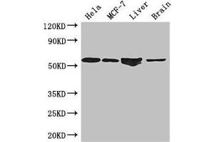 Western Blot Positive WB detected in: Hela whole cell lysate, MCF-7 whole cell lysate, Mouse liver tissue, Mouse brain tissue All lanes: ETS2 antibody at 2. (ETS2 抗体  (AA 9-185))