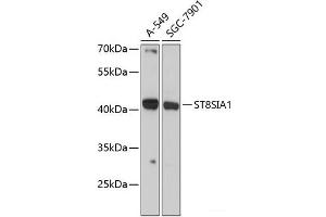 Western blot analysis of extracts of various cell lines using ST8SIA1 Polyclonal Antibody at dilution of 1:3000.