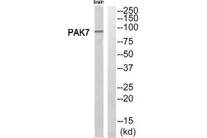 Western Blotting (WB) image for anti-P21 Protein (Cdc42/Rac)-Activated Kinase 7 (PAK7) (C-Term) antibody (ABIN1852718) (PAK7 抗体  (C-Term))