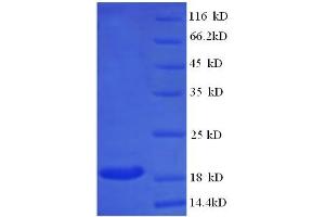 SDS-PAGE (SDS) image for Butyrylcholinesterase (BCHE) (AA 1-141), (full length) protein (His tag) (ABIN5709121)