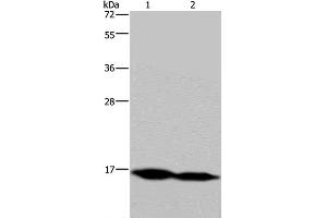 Western Blot analysis of Mouse skeletal muscle and Human hepatocellular carcinoma tissue using NDUFA13 Polyclonal Antibody at dilution of 1:350 (NDUFA13 抗体)