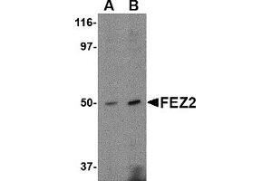 Western Blotting (WB) image for anti-Fasciculation and Elongation Protein zeta 2 (Zygin II) (FEZ2) (C-Term) antibody (ABIN1030393) (FEZ2 抗体  (C-Term))