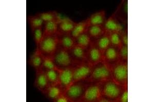 Immunofluorescence of human MCF7 cells stained with Phalloidin-TRITC (Red) for Actin staining and monoclonal anti-human MAPK1 antibody (1:500) with Alexa 488 (Green). (ERK2 抗体  (AA 1-360))