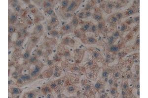 Immunohistochemistry (IHC) image for anti-Lectin, Galactoside-Binding, Soluble, 8 (LGALS8) (AA 1-317) antibody (ABIN7431593)
