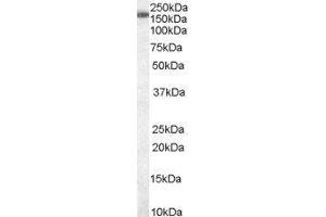 Western Blotting (WB) image for Squamous Cell Carcinoma Antigen Recognized By T Cells 3 (SART3) peptide (ABIN369434) (Squamous Cell Carcinoma Antigen Recognized By T Cells 3 (SART3) Peptide)