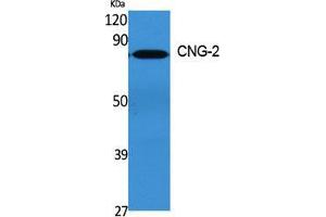Western Blot (WB) analysis of specific cells using CNG-2 Polyclonal Antibody. (CNGA2 抗体  (Internal Region))