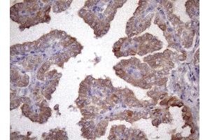 Immunohistochemistry (IHC) image for anti-Amelotin (AMTN) antibody (ABIN2716038) (Amelotin 抗体)