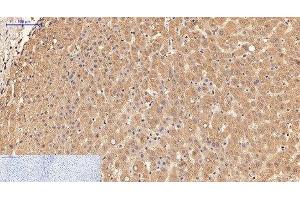 Immunohistochemistry of paraffin-embedded Human liver tissue using alpha Lactalbumin Monoclonal Antibody at dilution of 1:200. (LALBA 抗体)