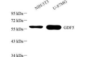 Western blot analysis of GDF5 (ABIN7074131)at dilution of 1: 1000 (GDF5 抗体)