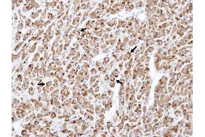 IHC-P Image Immunohistochemical analysis of paraffin-embedded U87 xenograft , using RELT, antibody at 1:100 dilution. (RELT 抗体  (Center))