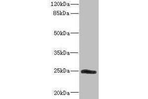 Western blot All lanes: SNRPB2 antibody IgG at 2. (SNRPB2 抗体  (AA 1-150))