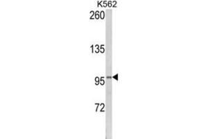 Western Blotting (WB) image for anti-Lipin 2 (LPIN2) antibody (ABIN3003814) (Lipin 2 抗体)