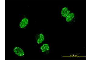Immunofluorescence of monoclonal antibody to TP53RK on HeLa cell. (TP53RK 抗体  (AA 154-253))