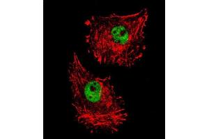 Confocal immunofluorescent analysis of FUS Antibody (C-term) (ABIN654146 and ABIN2844013) with MDA-M cell followed by Alexa Fluor 488-conjugated goat anti-rabbit lgG (green). (FUS 抗体  (C-Term))