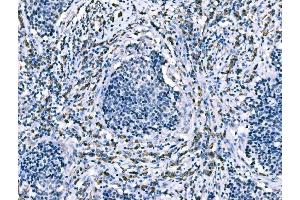 IHC analysis of CD101 using anti-CD101 antibody (ABIN7601981).