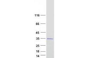 Western Blotting (WB) image for Guanidinoacetate N-Methyltransferase (GAMT) (Transcript Variant 1) protein (Myc-DYKDDDDK Tag) (ABIN2721681)