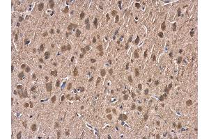 IHC-P Image HSP70 1A antibody detects HSP70 1A protein at cytoplasm in rat brain by immunohistochemical analysis. (HSP70 1A 抗体  (Center))