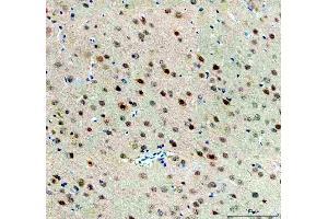 IHC analysis of FTO using anti-FTO antibody (ABIN7601059). (FTO 抗体  (AA 279-505))