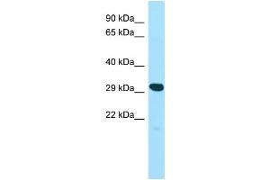 WB Suggested Anti-YIF1A Antibody Titration: 1. (YIF1A 抗体  (N-Term))