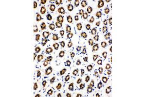 Immunohistochemistry (IHC) image for anti-Succinate Dehydrogenase Complex, Subunit C, Integral Membrane Protein, 15kDa (SDHC) (AA 35-50), (N-Term) antibody (ABIN3044203)