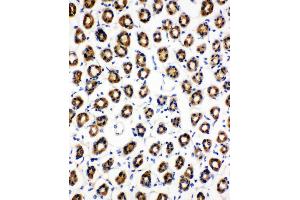 Anti-SDHC antibody, IHC(P) IHC(P): Rat Gaster Tissue (SDHC 抗体  (N-Term))