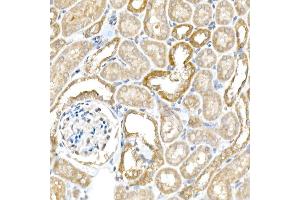 Immunohistochemistry of paraffin-embedded mouse kidney using B Rabbit pAb (ABIN6129977, ABIN6137413, ABIN6137415 and ABIN6220894) at dilution of 1:25 (40x lens). (BACE1 抗体  (AA 22-322))