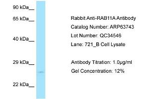 Western Blotting (WB) image for anti-RAB11A, Member RAS Oncogene Family (RAB11A) (C-Term) antibody (ABIN2774380) (RAB11A 抗体  (C-Term))