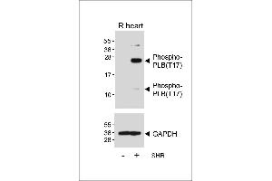 Western blot analysis of lysates from Rat heart tissue and spontaneous hypertensive (SHR) rat heart tissue lysate, using Phospho-PLB(T17) Antibody (ABIN650834 and ABIN2839801) (upper) or GDH (lower). (Phospholamban 抗体  (pThr17))