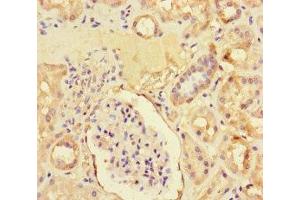 Immunohistochemistry of paraffin-embedded human kidney tissue using ABIN7176259 at dilution of 1:100 (ZNF366 抗体  (AA 455-650))