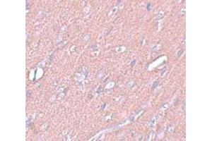 Immunohistochemistry (IHC) image for anti-Synaptogyrin 3 (SYNGR3) (C-Term) antibody (ABIN1030716) (Synaptogyrin 3 抗体  (C-Term))
