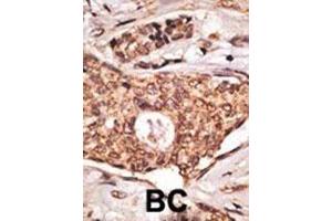 IHC analysis of FFPE human lymph node with ICOS antibody (ICOS 抗体  (AA 156-185))