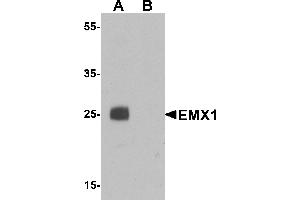 Western blot analysis of EMX1 in rat liver tissue lysate with EMX1 antibody at 1 µg/mL in (A) the absence and (B) the presence of blocking peptide.