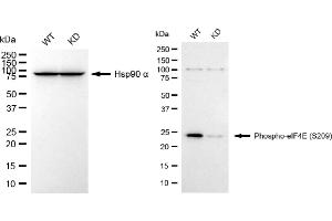 Western blotting analysis using phospho-eIF4E (S209) antibody (ABIN7798529). (Recombinant EIF4E 抗体  (pSer209))
