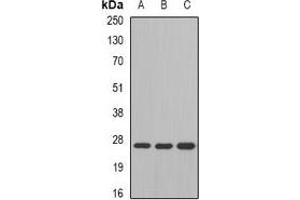 Western blot analysis of GSTM4 expression in SW480 (A), mouse liver (B), mouse lung (C) whole cell lysates. (GSTM4 抗体)