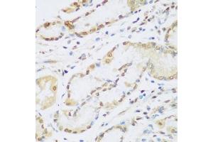 Immunohistochemistry of paraffin-embedded human stomach using CCND2 antibody (ABIN1875413) at dilution of 1:100 (40x lens). (Cyclin D2 抗体)