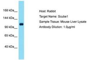 Image no. 1 for anti-Signal Peptide, CUB Domain, EGF-Like 1 (SCUBE1) (AA 518-567) antibody (ABIN6750516) (SCUBE1 抗体  (AA 518-567))