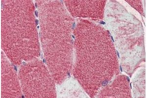 Human Skeletal Muscle: Formalin-Fixed, Paraffin-Embedded (FFPE) (POLG 抗体  (AA 829-1201))