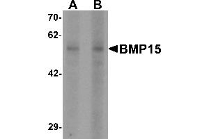 Western blot analysis of BMP15 in 3T3 cell lysate with BMP15 antibody at (A) 1 and (B) 2 µg/mL (BMP15 抗体  (N-Term))
